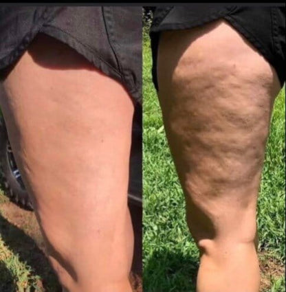 Anti-cellulite Massage Oil