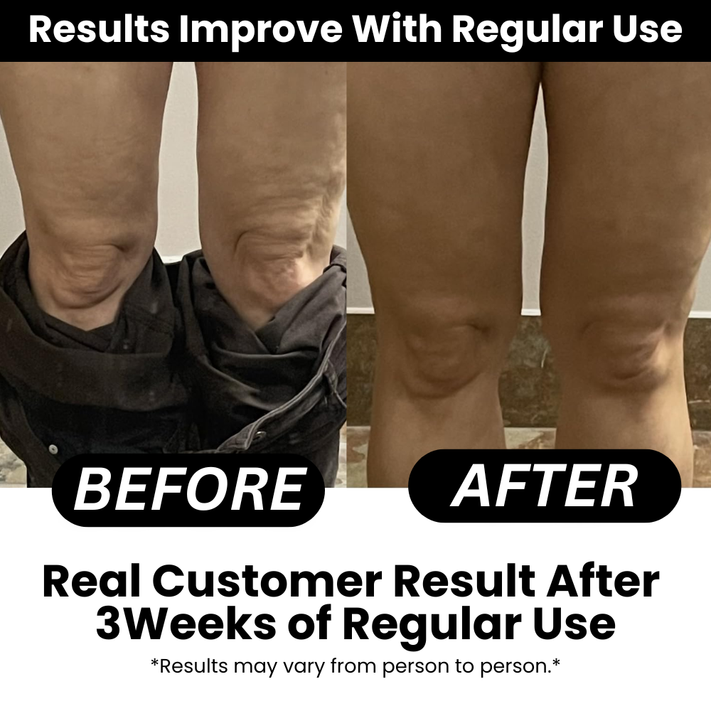 Aceite de masaje anticelulítico