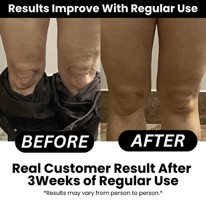 Aceite de masaje anticelulítico