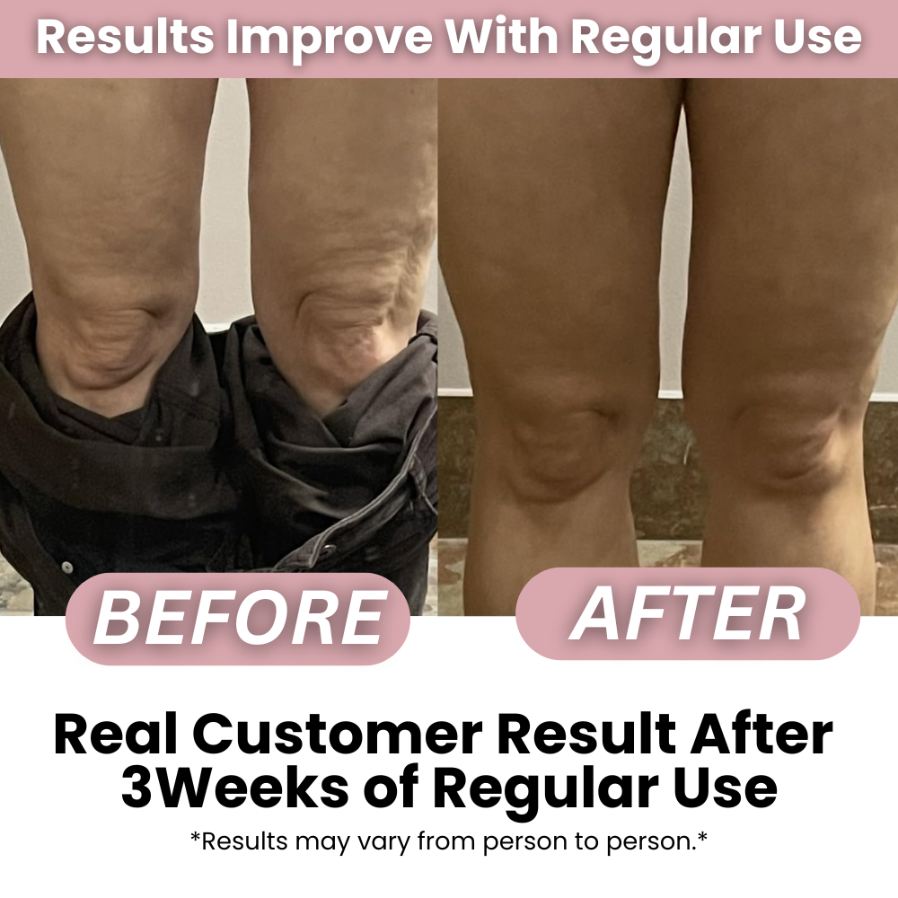 Anti-cellulite Massage Oil